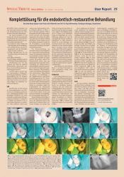 issueImage