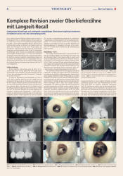 issueImage