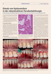 issueImage