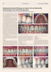 issueImage