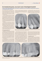 issueImage