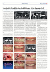 issueImage