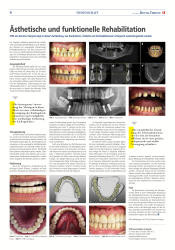 issueImage