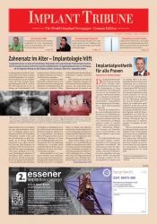 issueImage