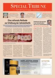 issueImage