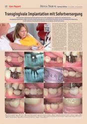issueImage
