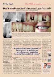 issueImage