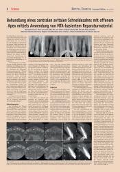 issueImage