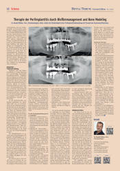 issueImage