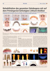 issueImage
