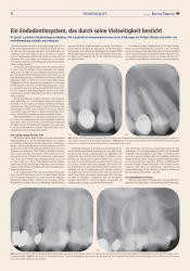 issueImage