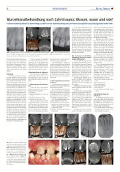 issueImage