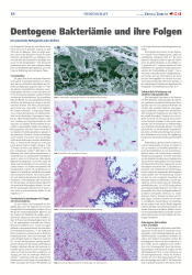 issueImage