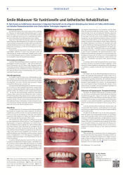issueImage