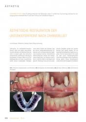issueImage