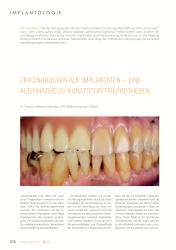 issueImage