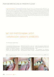 issueImage