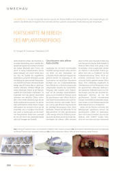 issueImage