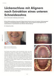 issueImage