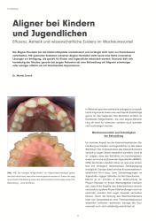 issueImage