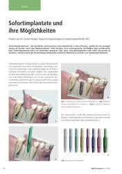 issueImage