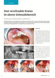 issueImage