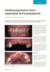 issueImage