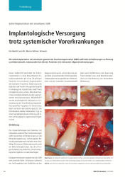issueImage
