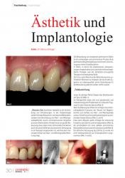 issueImage