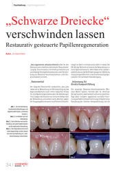issueImage