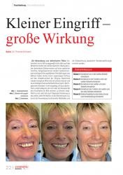 issueImage