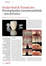issueImage