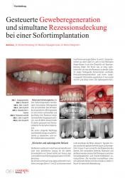 issueImage