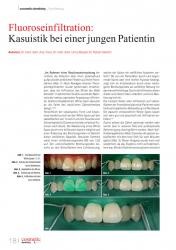 issueImage