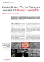 issueImage