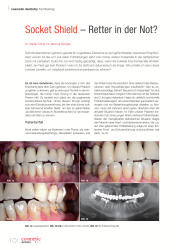 issueImage