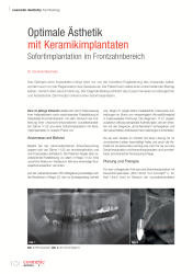 issueImage
