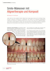 issueImage