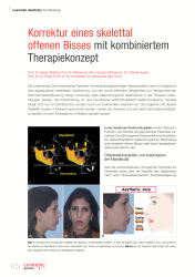issueImage