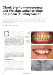 issueImage