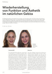 issueImage