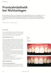 issueImage