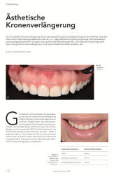 issueImage