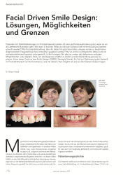 issueImage