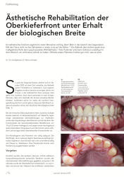 issueImage