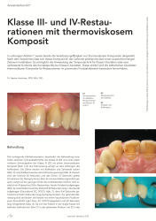 issueImage