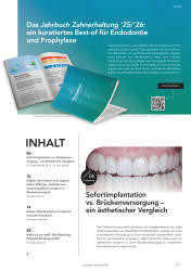 issueImage