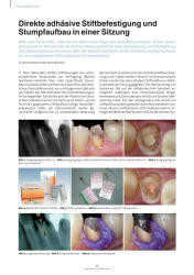issueImage