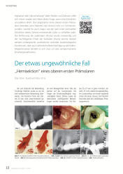issueImage