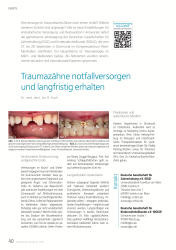 issueImage